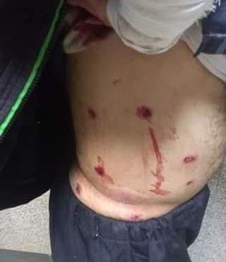 زخمی شدن دو کولبر در مرز نوسود 2 IMG 20220315 123638 909