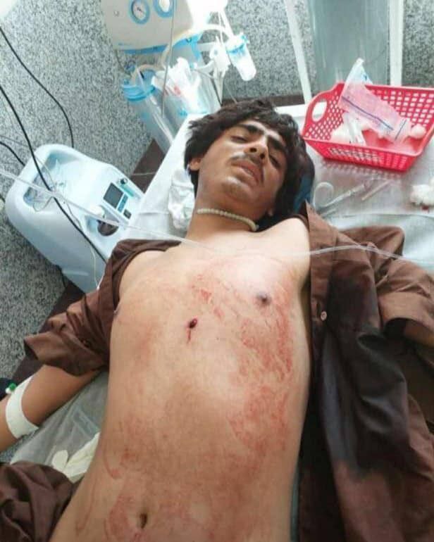 زخمی شدن یک شهروند بلوچ در پی تیراندازی نیروهای نظامی در شهرستان دوست محمد (هیرمند)