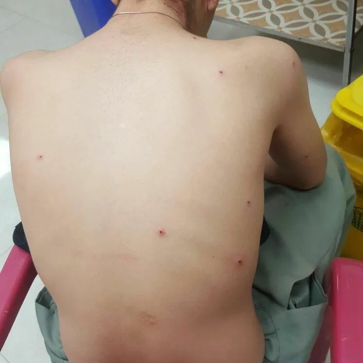 زخمی شدن یک کولبر جوانرودی در مرز نوسود
