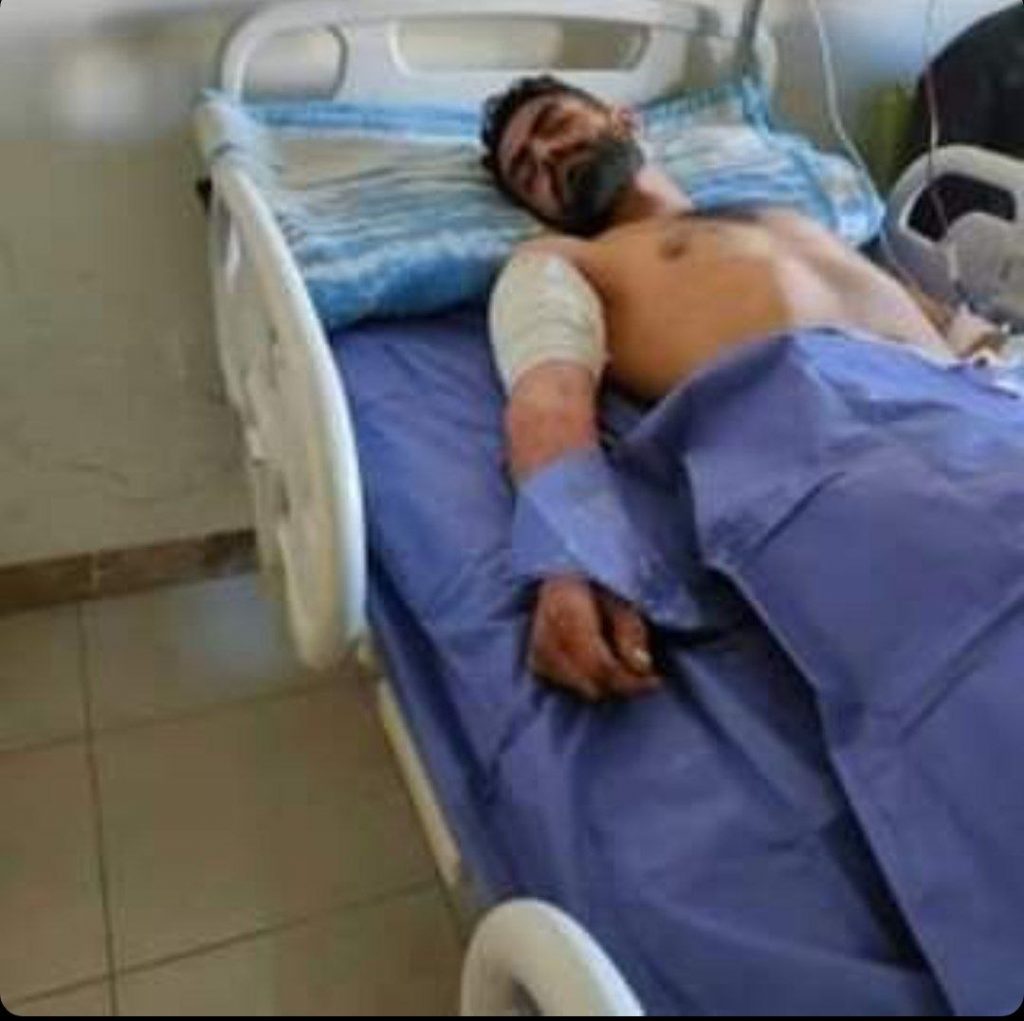 زخمی شدن یک کولبر اهل اقلیم کردستان در نوارمرزی سردشت
