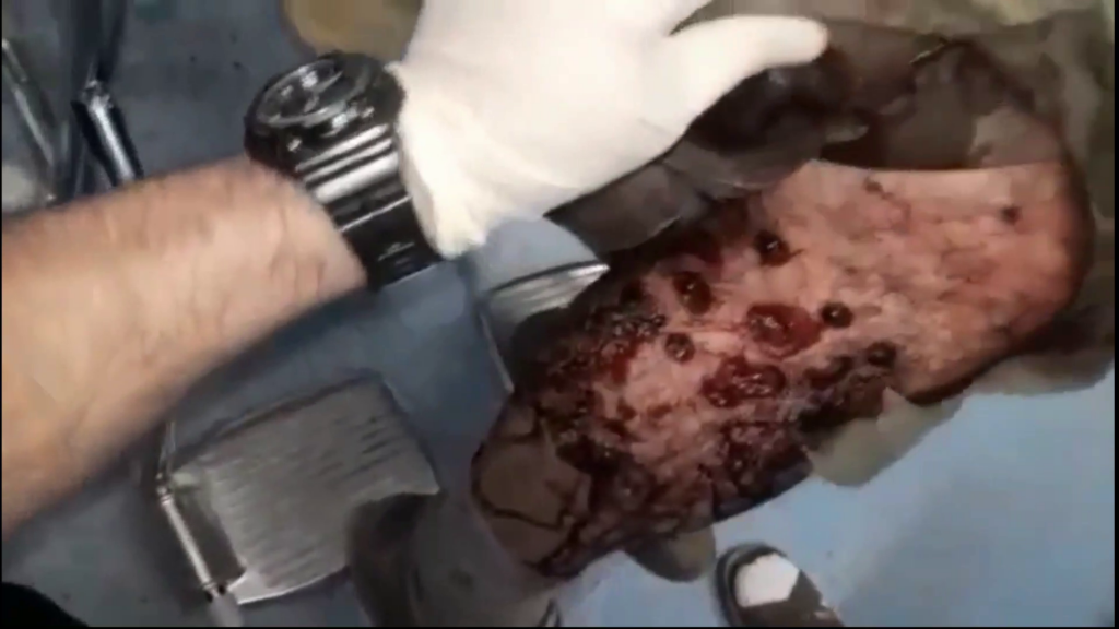 زخمی شدن یک کولبر در مرز نوسود+ویدیو
