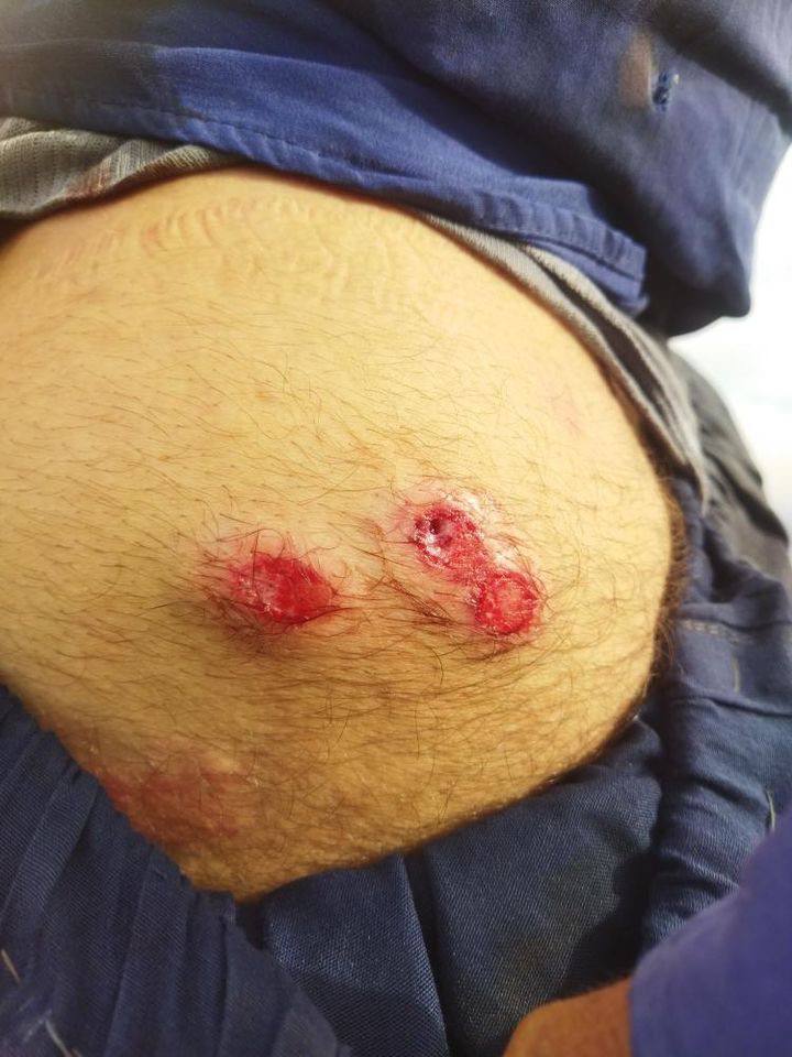 زخمی شدن یک کولبر در نوار مرزی ته‌ته هورامان