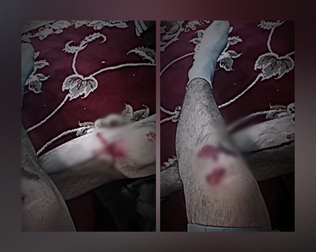 نوسود‌؛ زخمی شدن دو کولبر در پی تعقیب و گریز نیروهای هنگ‌مرزی+ویدیو