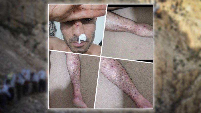 هنگژال؛ زخمی شدن دو کولبر براثر تیراندازی و ضرب و شتم نیروهای رژیم