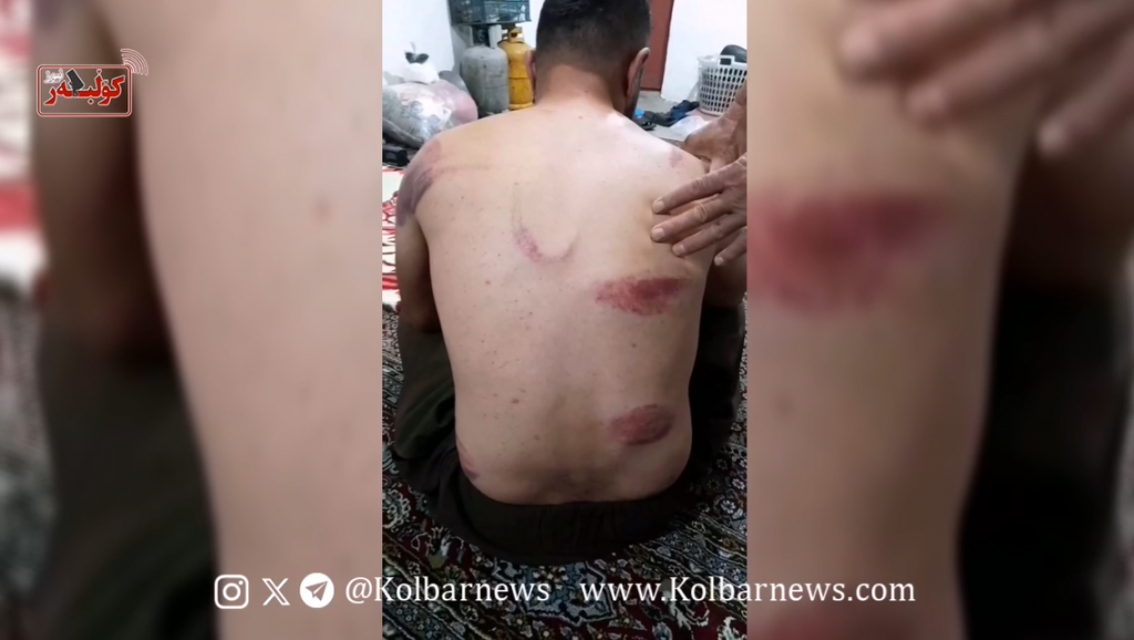 حلبچە؛ شکنجه و ضرب و شتم یک کولبر توسط نیروهای حرس‌الحدود عراق
