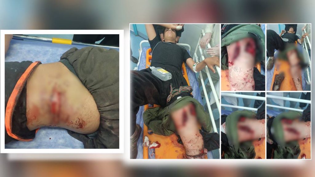 نوسود؛ احراز هویت دو کودک کولبر زخمی شده با تیراندازی نیروهای هنگ‌مرزی