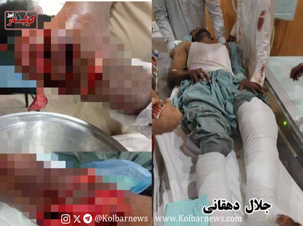 دشتیاری؛ مجروح شدن یک سوختبر بلوچ توسط نیروهای نظامی 3 photo 2025 07 30 21 26 46