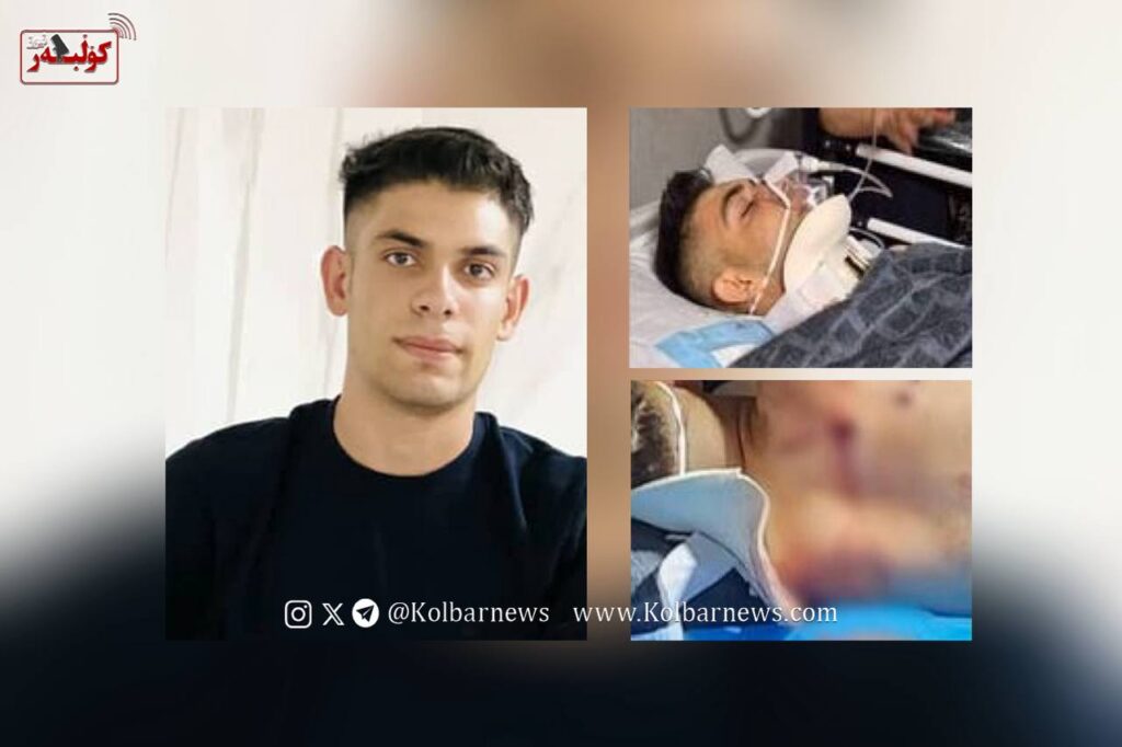 پاوه؛ زخمی شدن ژیوار رحمانی، نوجوان ۱۷ ساله بر اثر شلیک مستقیم نیروهای حکومتی